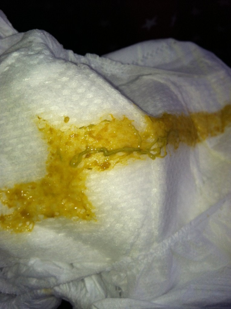 What causes bright yellow mucus?