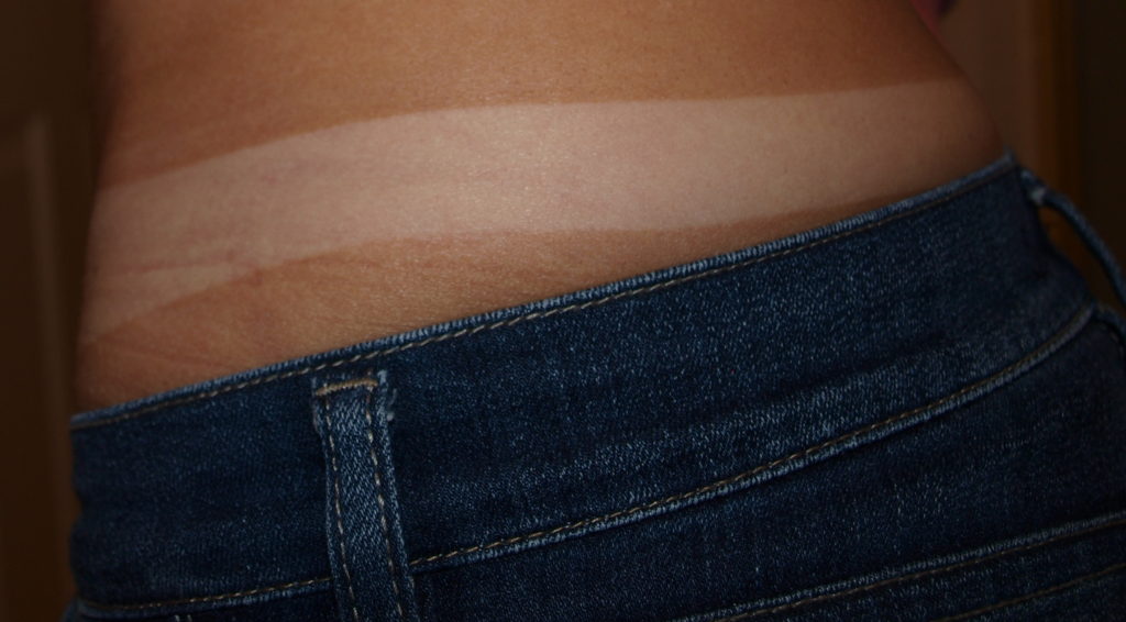 tan lines